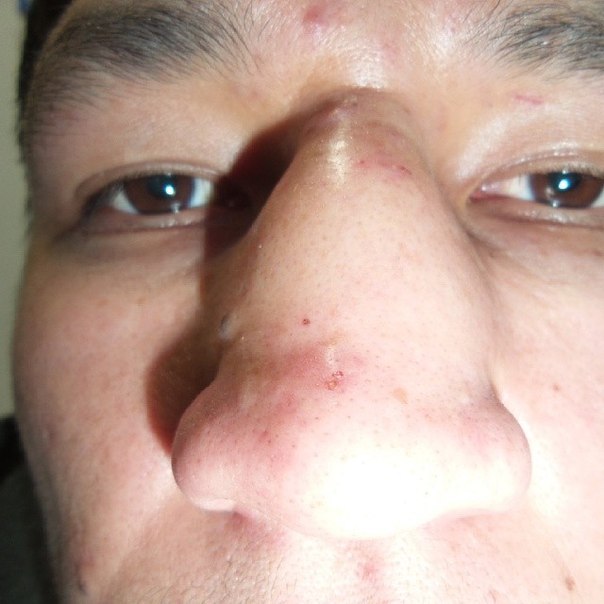 Файтер «Алаш Прайд» Куат Хамитов получил травму