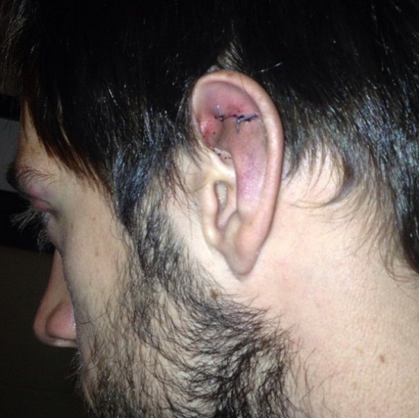 Защитник «Авангарда» травмировал ухо на тренировке