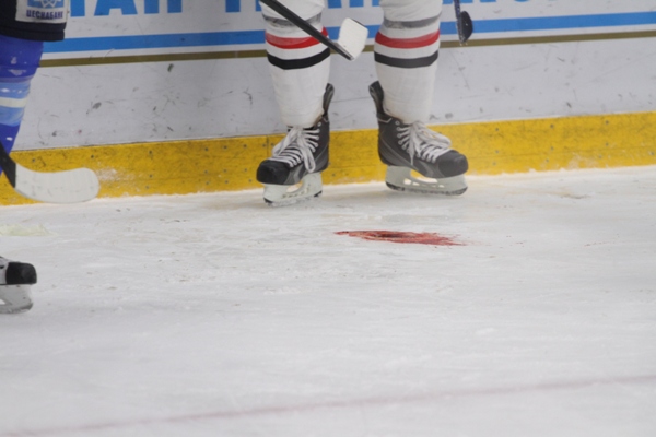 Хоккеист «Авангарда» получил черепно-мозговую травму