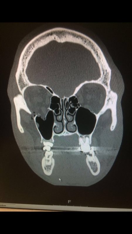Келл Брук: «Ингл вывел меня из боя, чтобы избежать большего вреда здоровью»