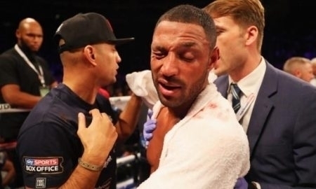 Американский боксёр считает, что травма глаза, полученная в бою с Головкиным, может помешать Бруку со Спенсом