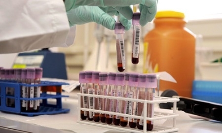 Уголовную ответственность за допинг внедрят в Казахстане