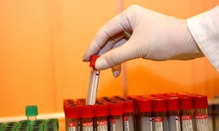 Казахстанских легкоатлетов среди заразившихся вирусной инфекцией в Лондоне нет