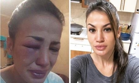 Казахстанская Анджелина Джоли поделилась страшным фото после избиения
