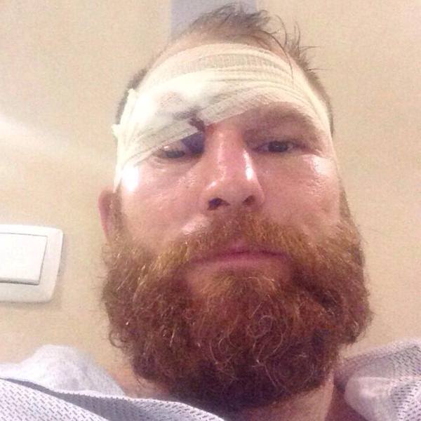 Несостоявшийся соперник Елеусинова засветил сорвавшую бой сечку