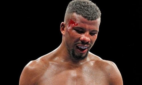 «Друг Головкина» залил весь ринг кровью и проиграл титульный бой