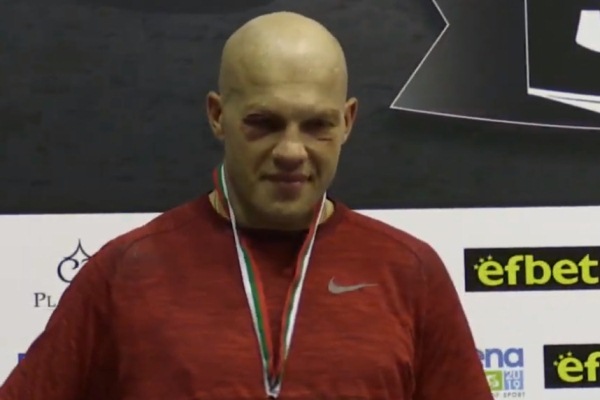 Синяки, ушибы и ссадины. Как выглядит лицо Левита после проигранного боя за «золото» турнира в Болгарии