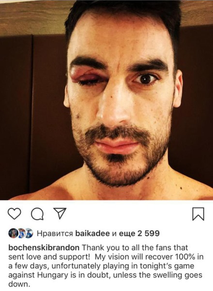 Боченски показал фото жуткой травмы глаза и сообщил новости о восстановлении
