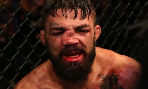 Боец UFC получил коленом по носу. Адское фото его травмы стало хитом в интернете