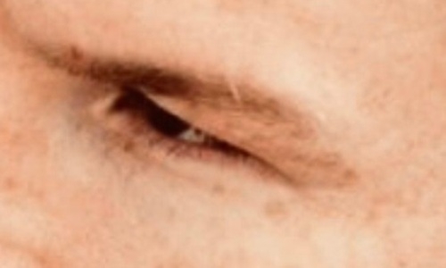 «Канело» спустя год все еще не залечил побои от Головкина. Фотофакт