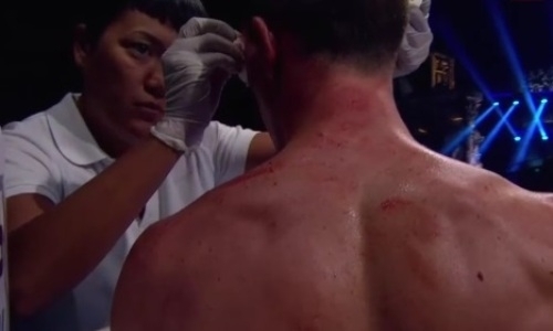 Украинский боксер получил рассечение и бой в Алматы завершился неожиданным итогом