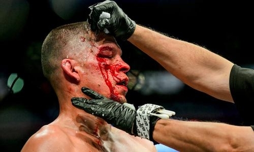 «Мне пишут все эти подонки». Остановивший бой за звание «Самого жесткого ублюдка» врач боится за свою жизнь