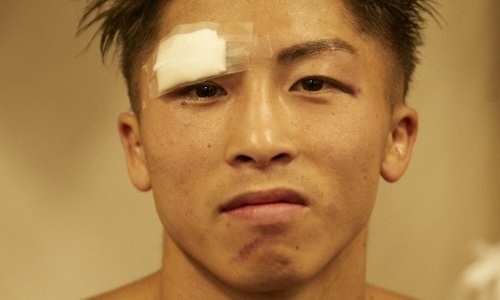 Как после Головкина. «Монстру» сломали глазницу в бою за два титула чемпиона мира