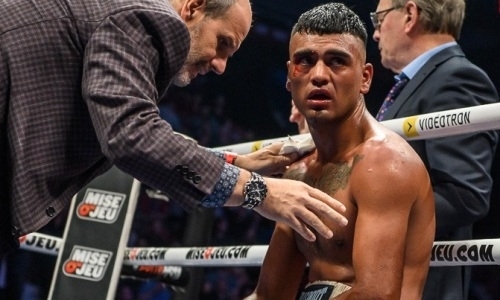 Врачи опасаются за здоровье жестоко нокаутированного казахстанцем боксера