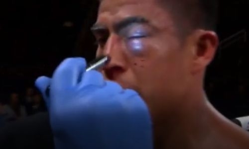 Бил, бил и прибил! Видео боя, или Как Данияр Елеусинов разбил глаз и нокаутировал экс-чемпиона WBC