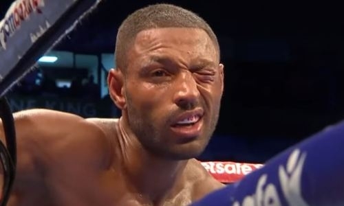 Жестоко избитый Головкиным экс-чемпион мира снова хочет драться с травмировавшим его боксером