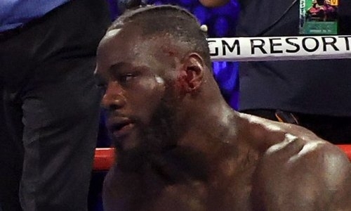 «Хуже нокаута». Стали известны ужасные последствия поражения от Фьюри для Уайлдера