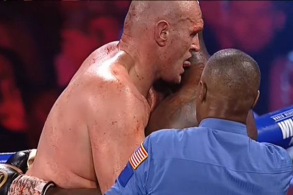 Фьюри облизывал Уайлдера во время боя. Фото