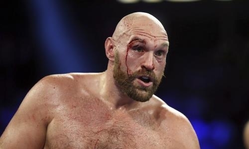 Тайсон Фьюри оказался под угрозой восьмилетней дисквалификации