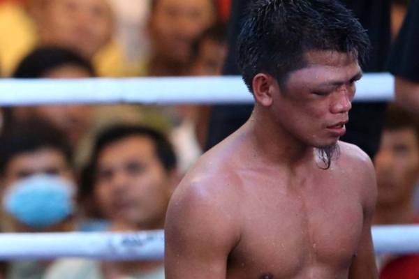 Узбекский боксер устроил избиение в бою за титул WBO. У соперника опухли оба глаза. Фото