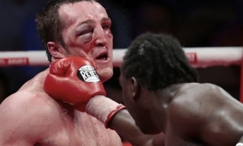 Денису Лебедеву после поражения нокаутом с сотрясением мозга позвонил Путин. Боксер озвучил слова президента