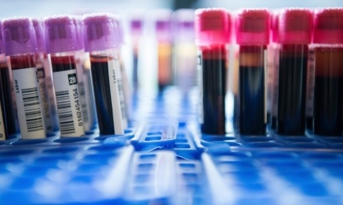 Полторанин и компания. Опубликован список дисквалифицированных за допинг казахстанских спортсменов