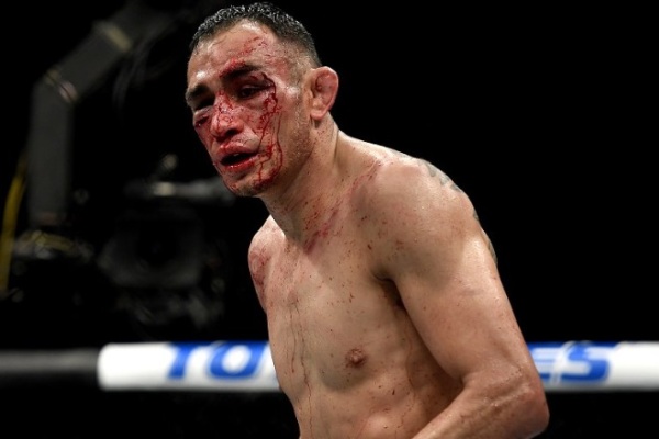 Как выглядело лицо Фергюсона после кровавого боя с Гэтжи. Фотофакт