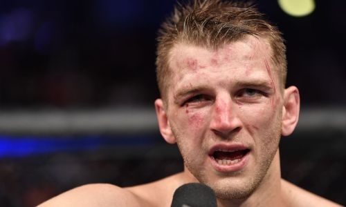 «Снова уеду в больницу». Хукер высказался о бое с Фергюсоном