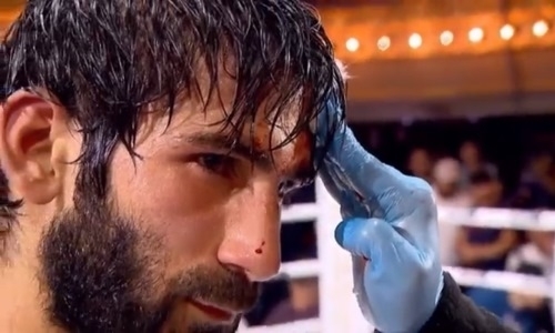 Жестко столкнулись головами. Украинский боксер завершил бой жутким рассечением. Видео