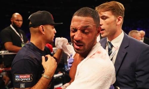 Избитый Головкиным экс-чемпион мира рассказал о своей самой большой ошибке в карьере