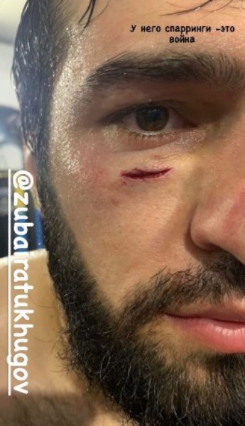 «У него спарринги — это война». Хабиб показал фото обидчика Хамитова с жесткими последствиями