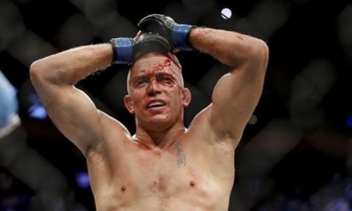 «Один из первых случаев, когда могу испытать на себе шампунь». Сен-Пьер отрастил волосы. Фото