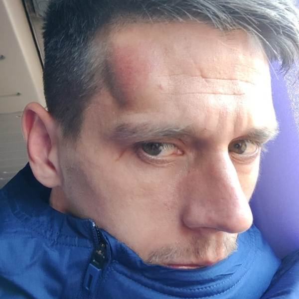 Зарубежный лидер клуба КПЛ получил сотрясение мозга