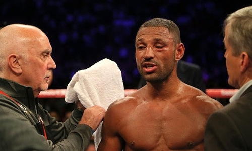 «Нет, нет, не делай этого». Брук рассказал о том самом моменте в бое с Головкиным. Видео