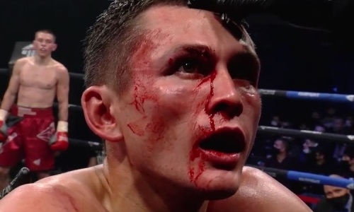 Как «Казахстанская ракета» с разбитым лицом и рассечением рубился с россиянином в Екатеринбурге. Видео