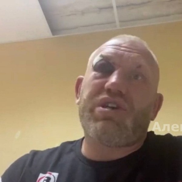 Появилось фото Сергея Харитонова после нападения российского бойца UFC