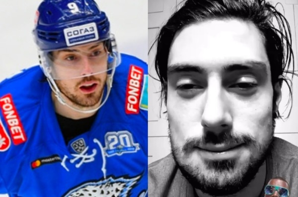 В Сети появилось первое фото Джесси Блэкера со сломанной челюстью