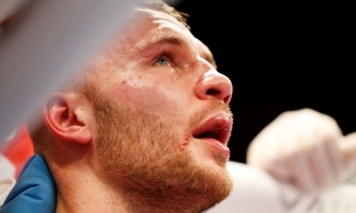 «У меня двое детей — мне есть ради кого жить». Шеремета раскрыл чудовищные последствия боя с Головкиным