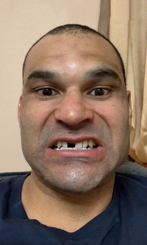 Нападающему сборной Казахстана выбили зуб. Фото