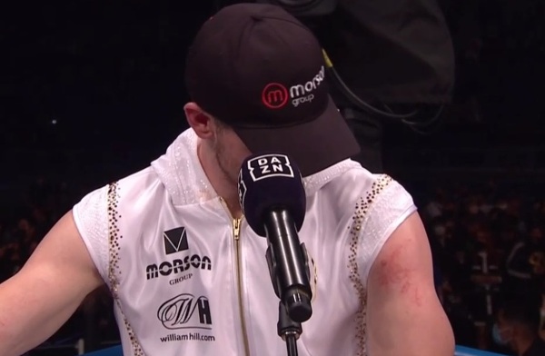 «Канело» нанес травму Смиту. Фотофакт