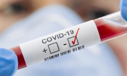 «Актобе» прошел тестирование на коронавирус перед матчем Лиги Чемпионов и узнал результаты