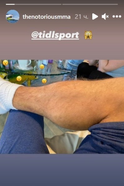 Конор Макгрегор показал свою травму через две недели после поражения от Порье