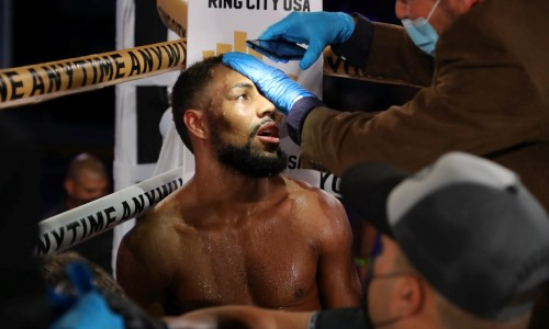«Выглядел не очень хорошо». Казахстанского боксера заподозрили в нанесении умышленного вреда здоровью соперника
