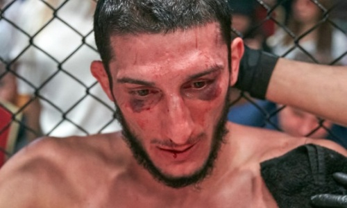 Казахстанский боец получил переломы стопы и кисти в бою за титул чемпиона Fight Nights