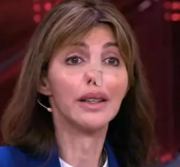 Бывшая жена экс-футболиста «Кайрата» впервые появилась на ТВ с изуродованным лицом. Фото