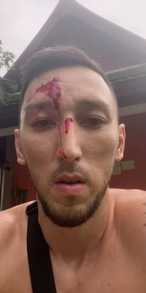 Менеджер бойцов UFC Жумагулова и Морозова попал в аварию и сразу показал последствия. Фото