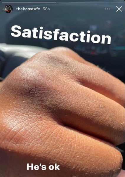 Претендент на титул чемпиона UFC задержал грабителя своей машины и показал последствия встречи. Фото и Видео