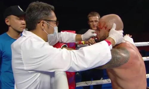 22-летний казахстанский боксер разбил лицо чемпиону России. Тот снялся с боя