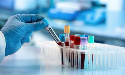 Есть ли случаи КВИ среди казахстанцев на Олимпиаде в Токио