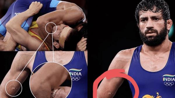 «Было больно». Казахстанский борец укусил соперника в схватке за финал Олимпиады-2020. Фото и видео